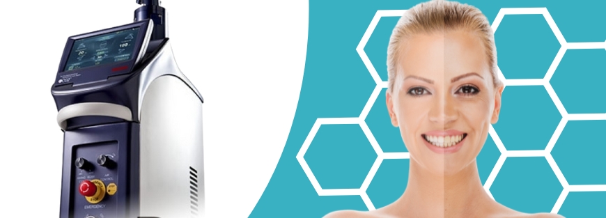 Laser de CO₂ Fracionado Dual Deep
