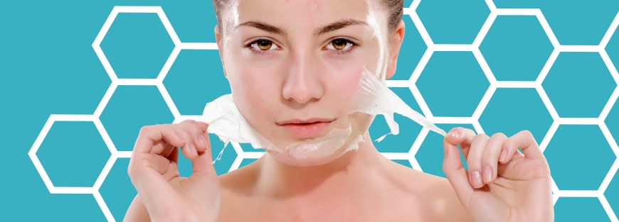 Peeling Químico