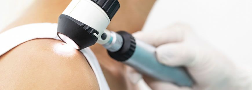 Dermatoscopia